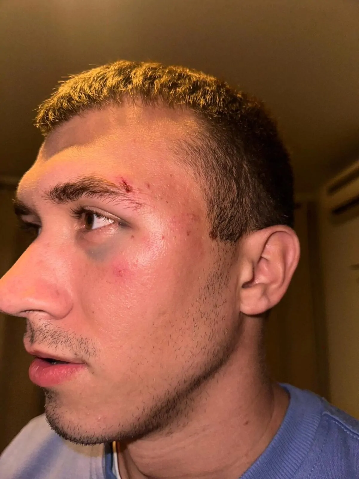 BRUTALAN I SRAMOTAN NAPAD NA IGRAČE ONK METKOVIĆ U OREBIĆU - Objava.hr 