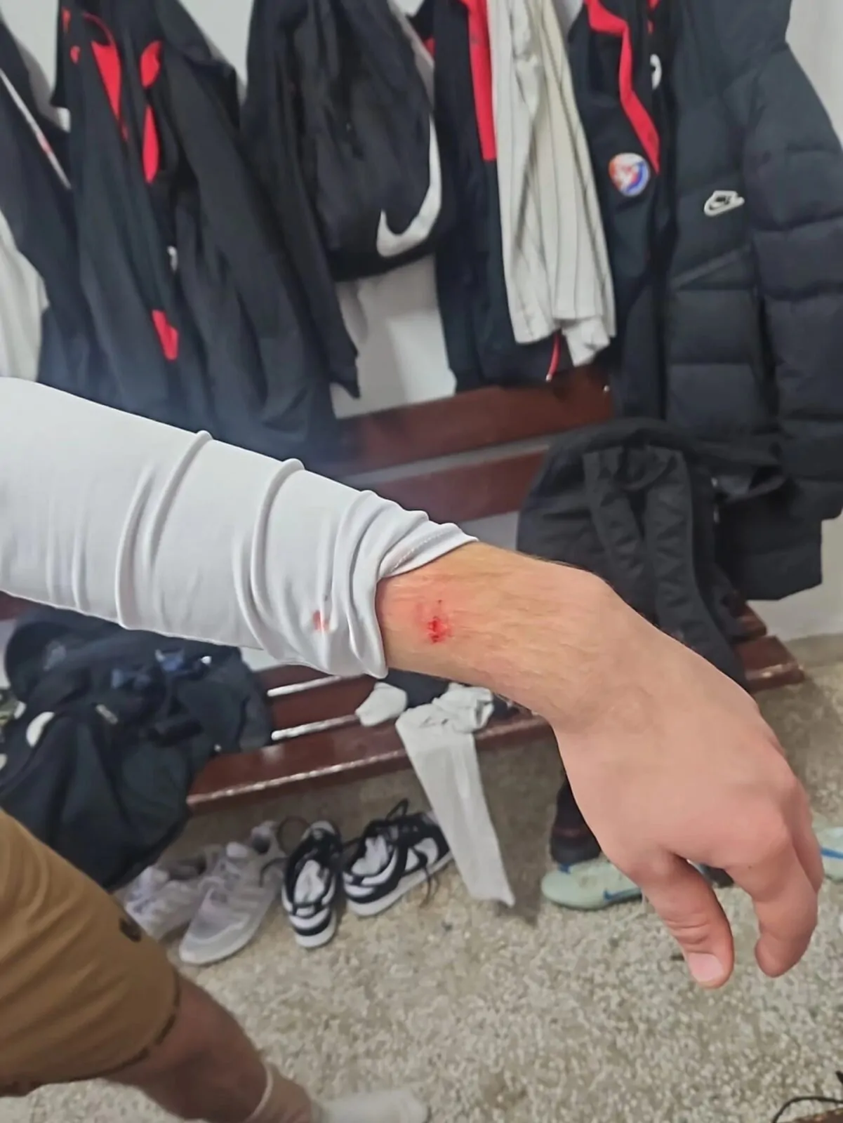 BRUTALAN I SRAMOTAN NAPAD NA IGRAČE ONK METKOVIĆ U OREBIĆU - Objava.hr 